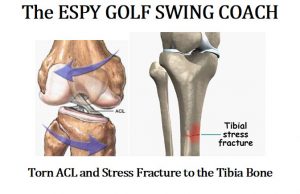 These discomforts, soreness, and eventually injuries show up as pain in the lumbar area, knees, shoulders, elbows, and wrists. If you recall one of Tiger Woods' most amazing displays of mental toughness was at his last major he won, the 2008 U.S. Open at Torrey Pines. Tiger Woods not only played 72 holes with a torn ligament and a double fracture to his left tibia, but he played in an 18-hole playoff with Rocco Mediate on the following Monday to win the U.S. Open.