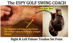 The critical Palmeris longus tendon used to Sync/Preset the forearm and wrists.
